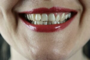 Mat som missfärgar tänderna och hur man motverkar det
